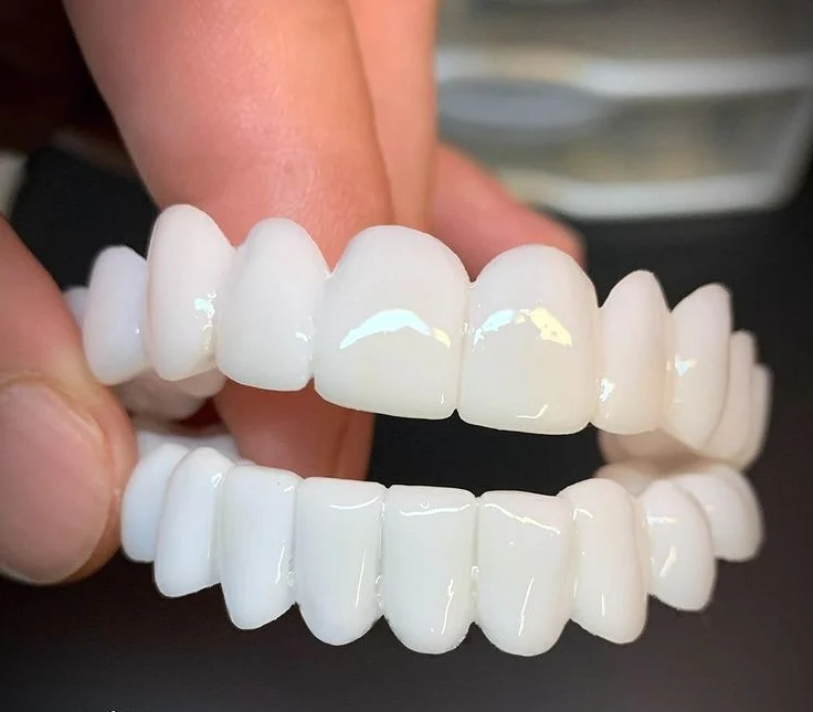 Cosmetische Tandtoppers SmileVorm – Herbruikbaar, Flexibel en Natuurlijk Wit
